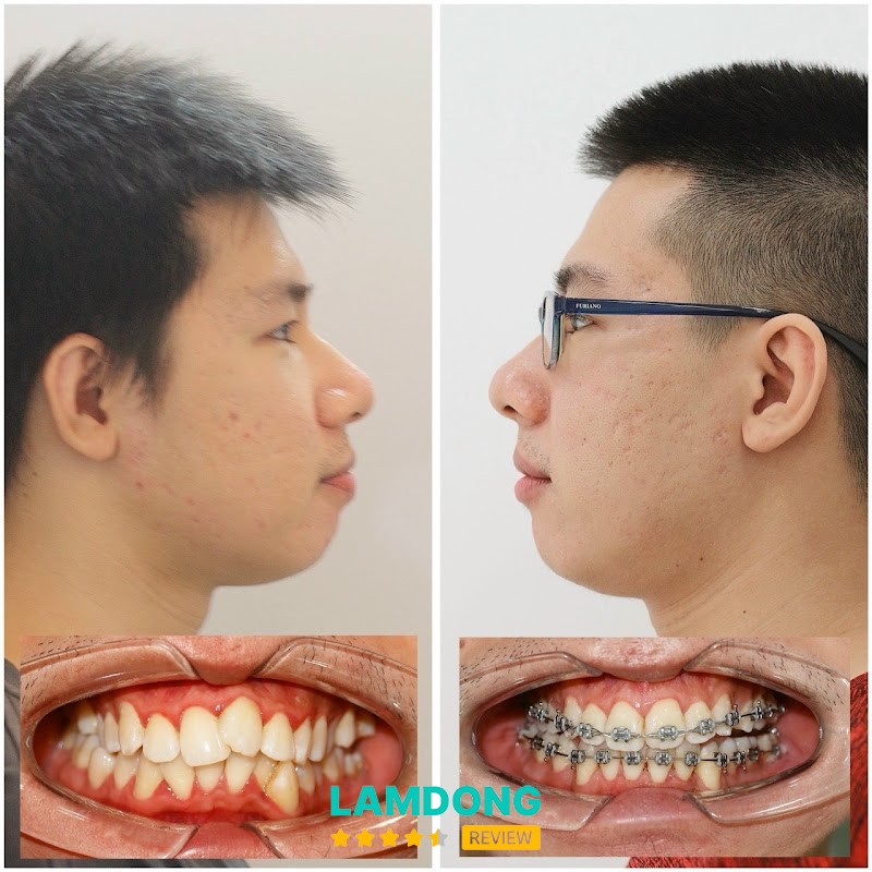 Nha Khoa Bác sĩ Lân - thiết bị hiện đại