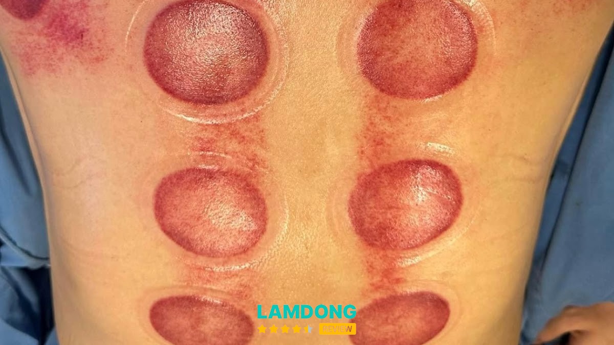 Massage Châm Cứu Bấm Huyệt Trị Liệu Hoa Đông y – 270 Hoàng Văn Thụ