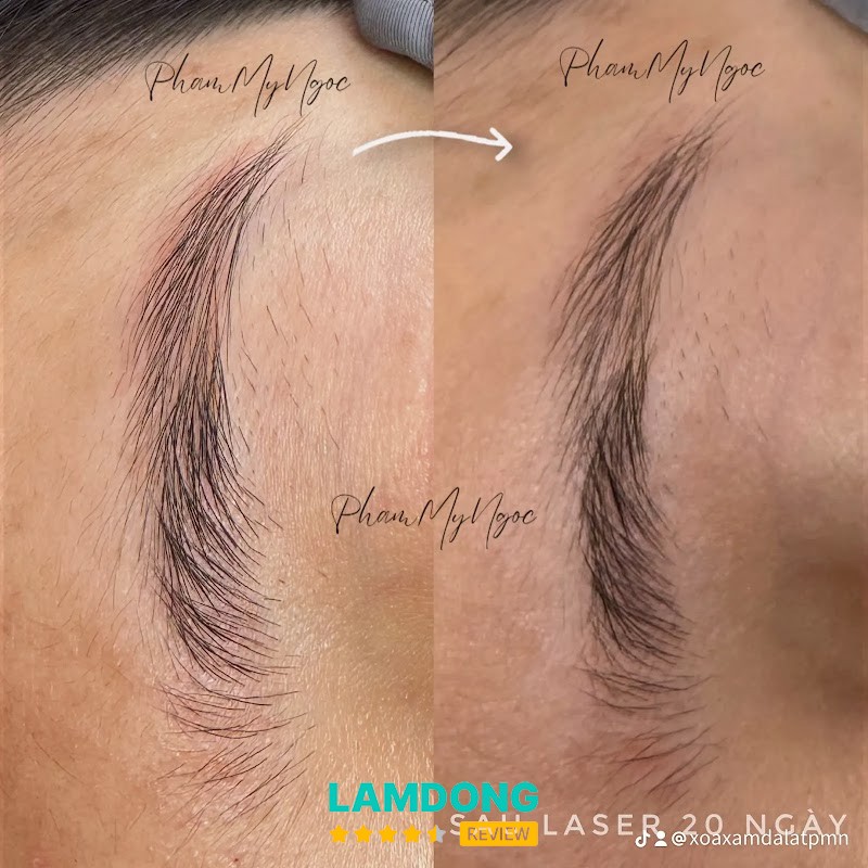 Xoá Xăm Đà Lạt - Phạm Mỹ Ngọc – Triệu Việt Vương