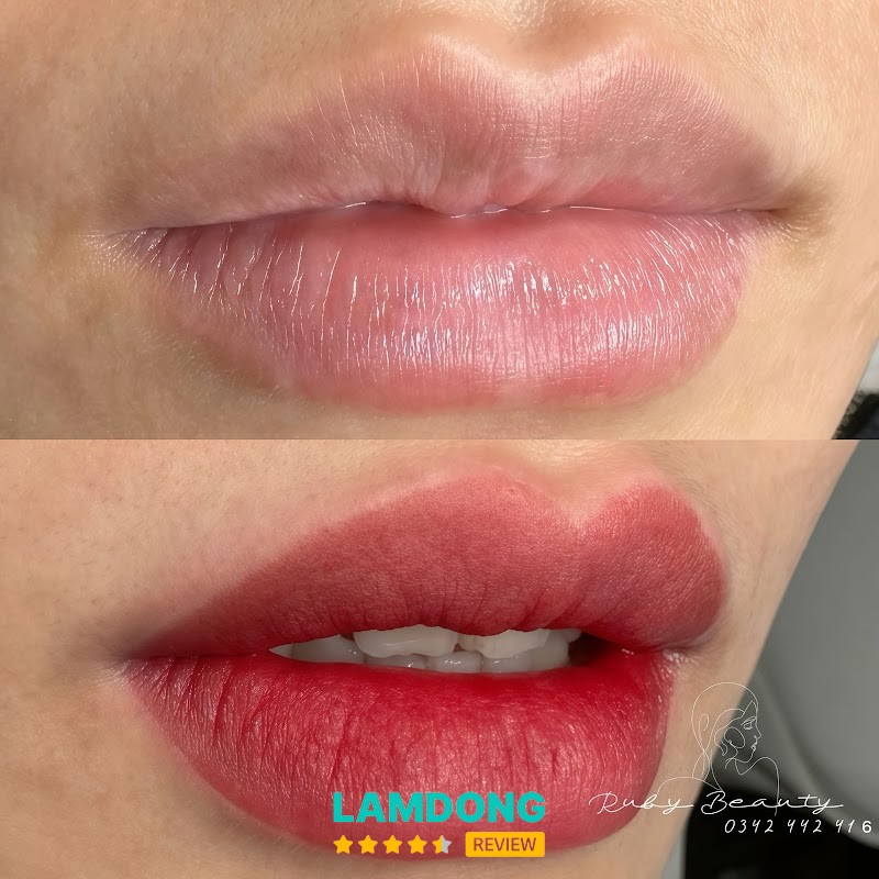Ruby - Xoá Xăm Đà Lạt – 99/2 Phù Đổng Thiên Vương