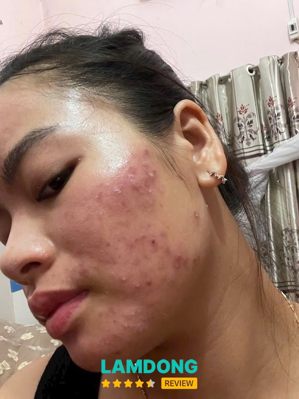 Hà Nguyễn Spa & Clinic Beauty – không gian dịch vụ