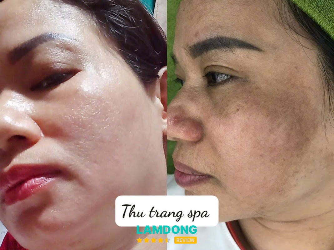 Spa Thu Trang – dịch vụ chăm sóc