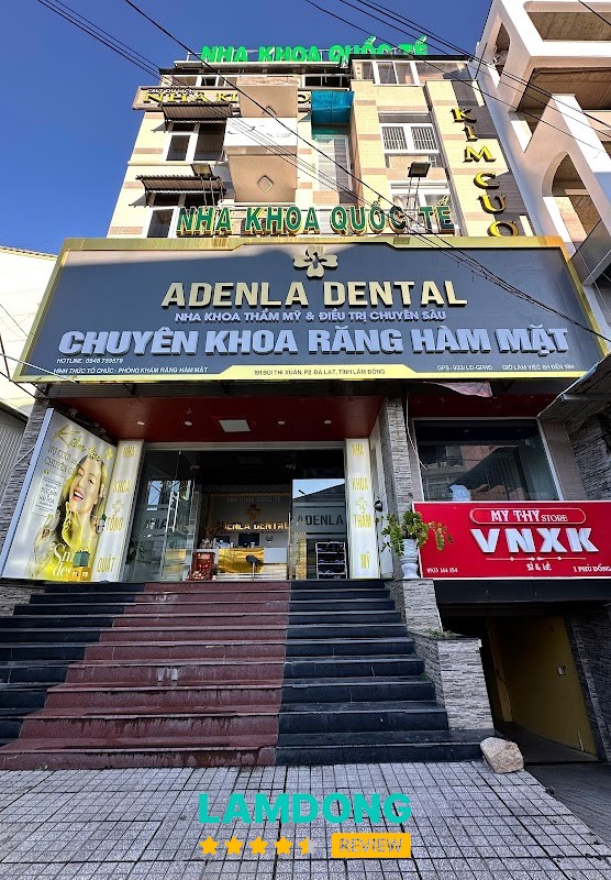 Nha Khoa Quốc Tế Adenla – dán sứ veneer ở Đà Lạt