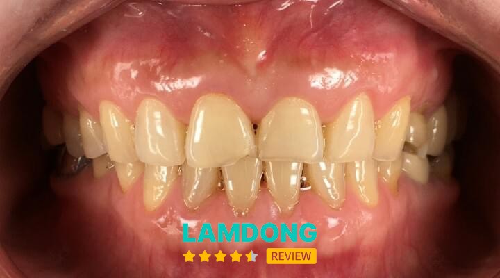 Nha Khoa Thánh Tâm - Bảo Lộc – 10 Nguyễn Tri Phương